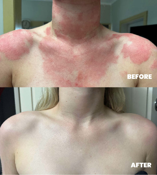 Before_and_After_f0d698cc-5fe1-4512-9a6a-9cbbe5fdd5d1.jpg
