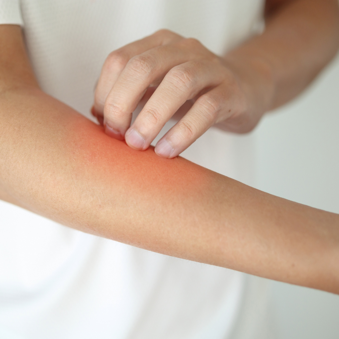 Why Is My Skin So Itchy? Causes and How to Get Relief