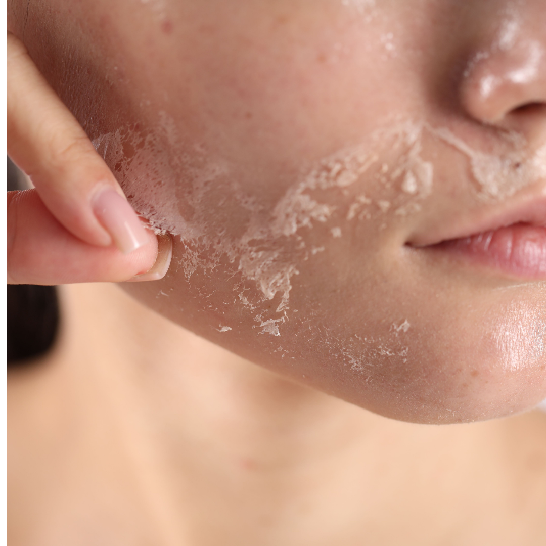 Why Is My Skin So Dry? Causes and How to Fix It