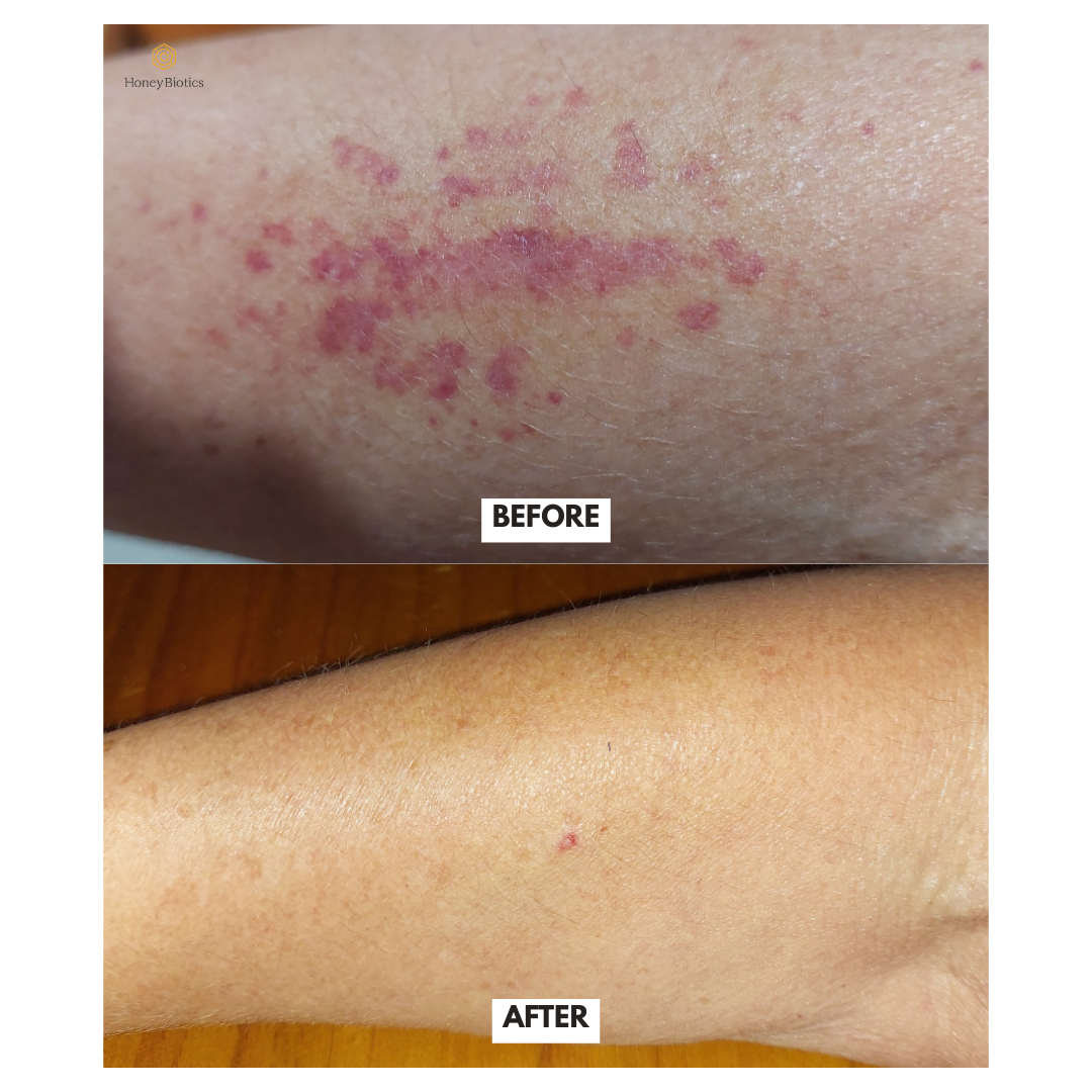 Honey Biotics Intense Moisturiser — photo 4