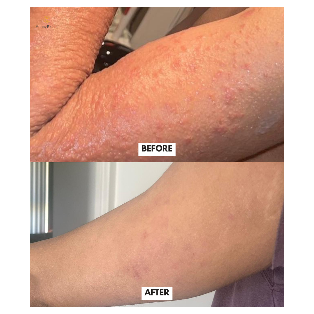 Honey Biotics Intense Moisturiser — photo 2
