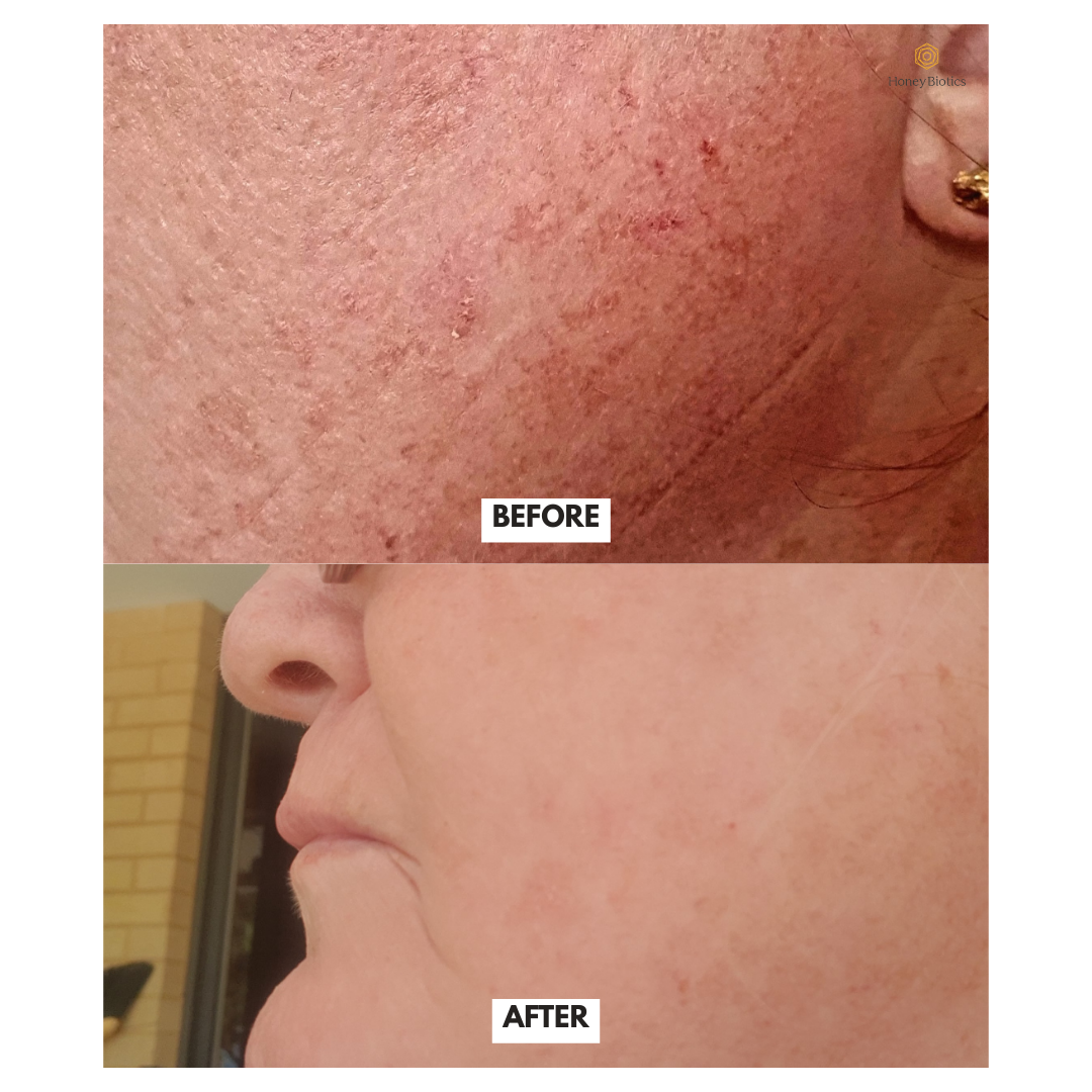 Honey Biotics Intense Moisturiser — photo 5