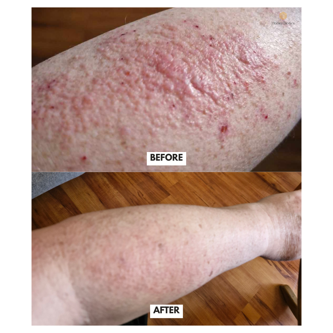 Honey Biotics Intense Moisturiser — photo 3