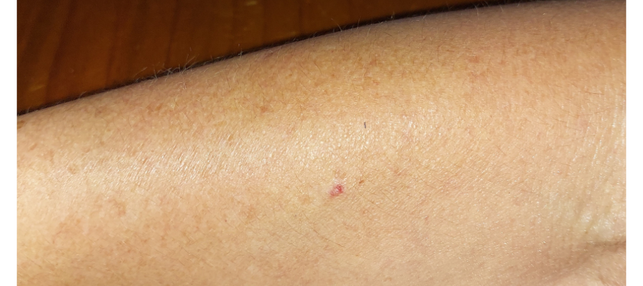 After - clear, calm skin
