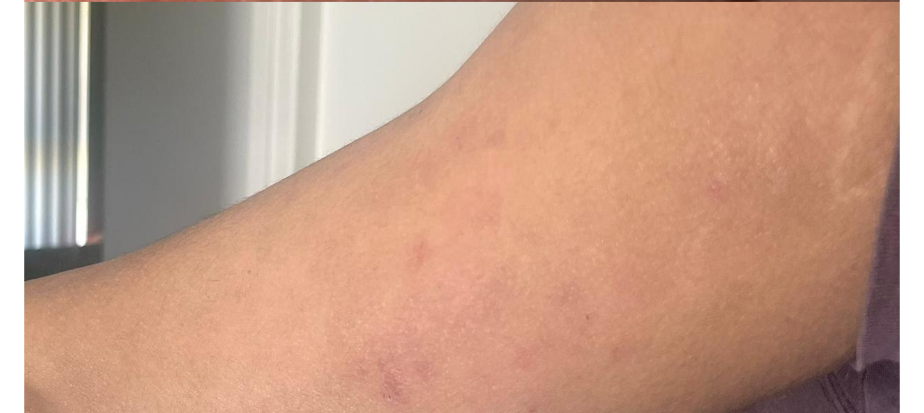 After - clear, calm skin