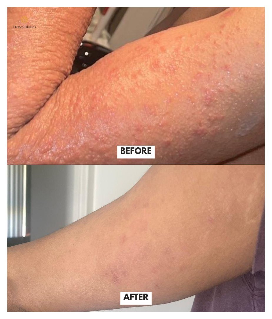 Before and after — facial irritation