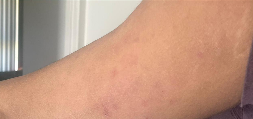 After: clear, calm skin